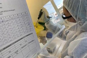 Vụ mua kit test Việt Á: Cách làm rất khác của CDC Tiền Giang