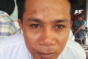 Tạm đình chỉ vụ án vì... đánh nhau vào chạng vạng tối