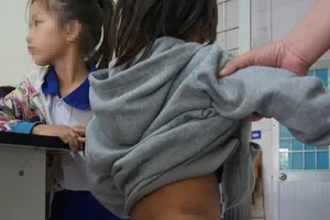 Công an TP Cà Mau báo cáo nhanh vụ 4 trẻ em bị bạo hành