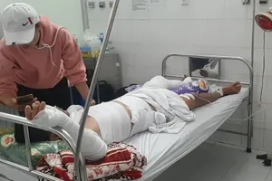 Cà Mau: Nổ ghe lưới ghẹ, 3 ngư dân bị thương