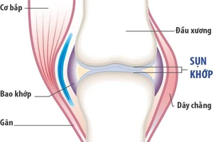 Thoái hóa khớp hay viêm khớp dạng thấp?
