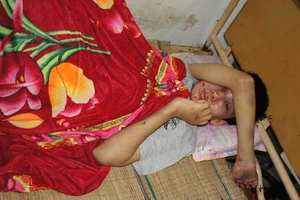 Giải cứu bé trai khuyết tật bị bắt cóc, đánh đập, đốt dã man