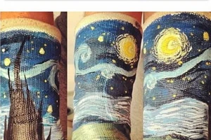 Nghệ thuật trên những cánh tay gãy