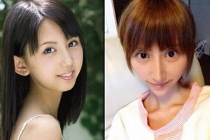 10 thảm họa thẩm mỹ châu Á gây chú ý trong 2014 