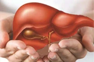 Khuyến cáo phòng bệnh viêm gan A