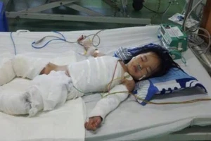 Nghịch nước sôi, bé gái hai tuổi nguy kịch