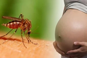 Mỹ khẳng định virus Zika gây ra chứng đầu nhỏ