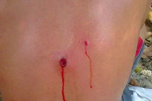 Công an bắt đá gà, một thanh niên bị trúng đạn