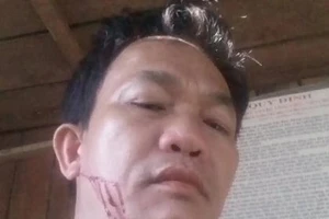 Chở gỗ lậu còn chửi bới rồi chém cán bộ kiểm lâm