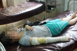 Bị chồng tạt nước sôi chỉ vì... đi xăm chân mày