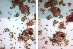 Chân bê bết máu vì rệp biển ăn thịt người