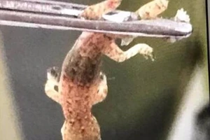 Kinh hoàng phát hiện thạch sùng trong tai bệnh nhân