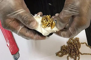 Nhét 1 kg vàng trong hậu môn để qua mặt hải quan