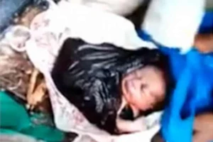 Bé sơ sinh sống sót kỳ diệu khi bị bỏ rơi ở bãi rác