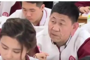 Bệnh lạ khiến chàng trai 18 trông như ông cụ 80