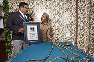 Quyết định cắt bỏ bộ móng tay đã nuôi dài 66 năm