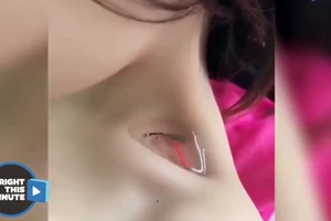 Choáng với trào lưu nuôi cá trong hõm xương quai xanh