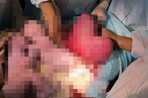 Kỳ diệu mẹ sinh đôi với tử cung hình trái tim