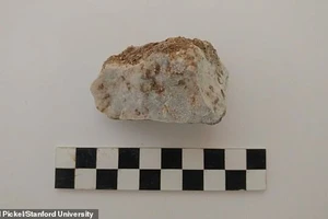 Phát hiện 'đứa bé ma cà rồng' với hòn đá trong miệng