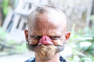 Choáng với người đàn ông có thể dùng lưỡi liếm tới trán