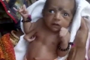 Bé gái sinh ra có 3 bàn tay được tôn thờ như vị thần