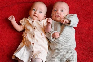 Kì lạ cặp song sinh ra đời cách nhau 12 ngày