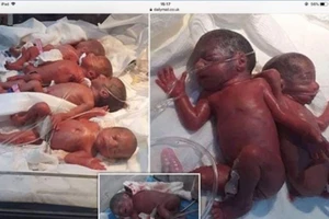 Kì diệu mẹ sinh thường một lúc 7 người con