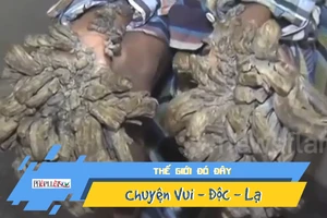 Căn bệnh 'người cây' khủng khiếp đeo bám chàng trai trẻ