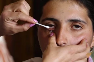 Kỳ lạ cô gái mỗi ngày khóc ra 50 viên thủy tinh