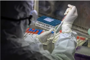 Bộ dụng cụ chẩn đoán virus COVID-19 được phát triển tại một phòng thí nghiệm ở Quảng Đông, Trung Quốc, tỉnh bị ảnh hưởng nặng thứ hai trong vụ dịch. Ảnh: EPA-EFE