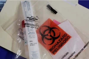 Một bộ xét nghiệm COVID-19 tại Trung tâm y tế Harborview ở Seattle, bang Washington (Mỹ) Ảnh: AP