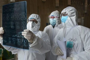 Các bác sĩ kiểm tra ảnh chụp phổi của bệnh nhân tại một bệnh viện ở tỉnh Hồ Bắc vào tháng trước. Ảnh: AFP