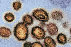 Virus SARS-CoV-2 dưới kính hiển vi. Ảnh: AFP