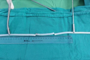 Người đàn ông nhét keo nến vào niệu đạo để tạo khoái cảm