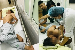 3 ca bệnh uốn ván nặng, nguy cơ tử vong cao chỉ trong 2 tuần