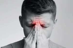 Đau đầu đột ngột: Cảnh báo căn bệnh nguy cơ tử vong nhanh chóng