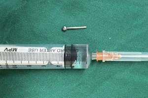 Cô gái bị chiếc khuyên đeo ở lưỡi rơi xuống dạ dày trong khi ăn