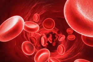 Dấu hiệu nhận biết cơ thể bị thiếu máu, thiếu sắt