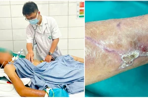 Nguy kịch sau khi bị cành cây đâm vào tay