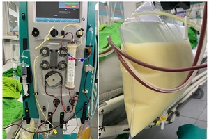 Người phụ nữ nặng 45kg có chỉ số mỡ máu cao gấp 37 lần bình thường