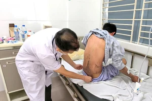 Bỏng toàn thân, mù tạm thời do tiếp xúc silicon chống dột