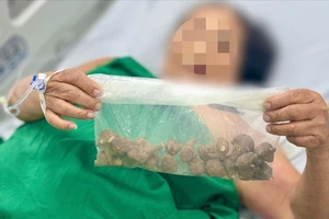 Bà cụ 78 tuổi suýt chết vì uống củ ấu tàu chữa đau khớp