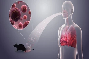 Bộ Y tế cảnh báo khẩn sau vụ 3 người tử vong do virus Hanta trên tàu du lịch