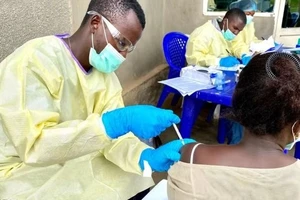 Bệnh Ebola có triệu chứng giống cúm, làm sao để phân biệt?
