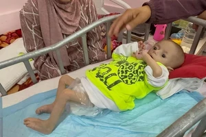 Ở Gaza, nạn đói và những chiếc xương sườn của trẻ em
