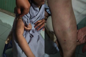 Bé gái bảy tuổi bị đánh bầm tím trong cơ sở tu tại gia