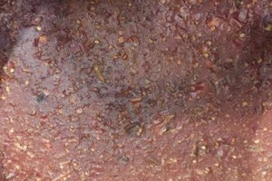 Kinh hãi giòi lúc nhúc trong tương ớt