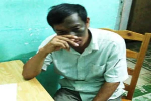 Tạt acid hàng xóm, 4 người bị bỏng nặng