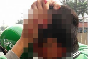 Đồng Nai: Xe ôm truyền thống tấn công tài xế GrabBike