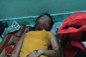 Người phụ nữ bị chém vào mặt kêu cứu trong phòng trọ